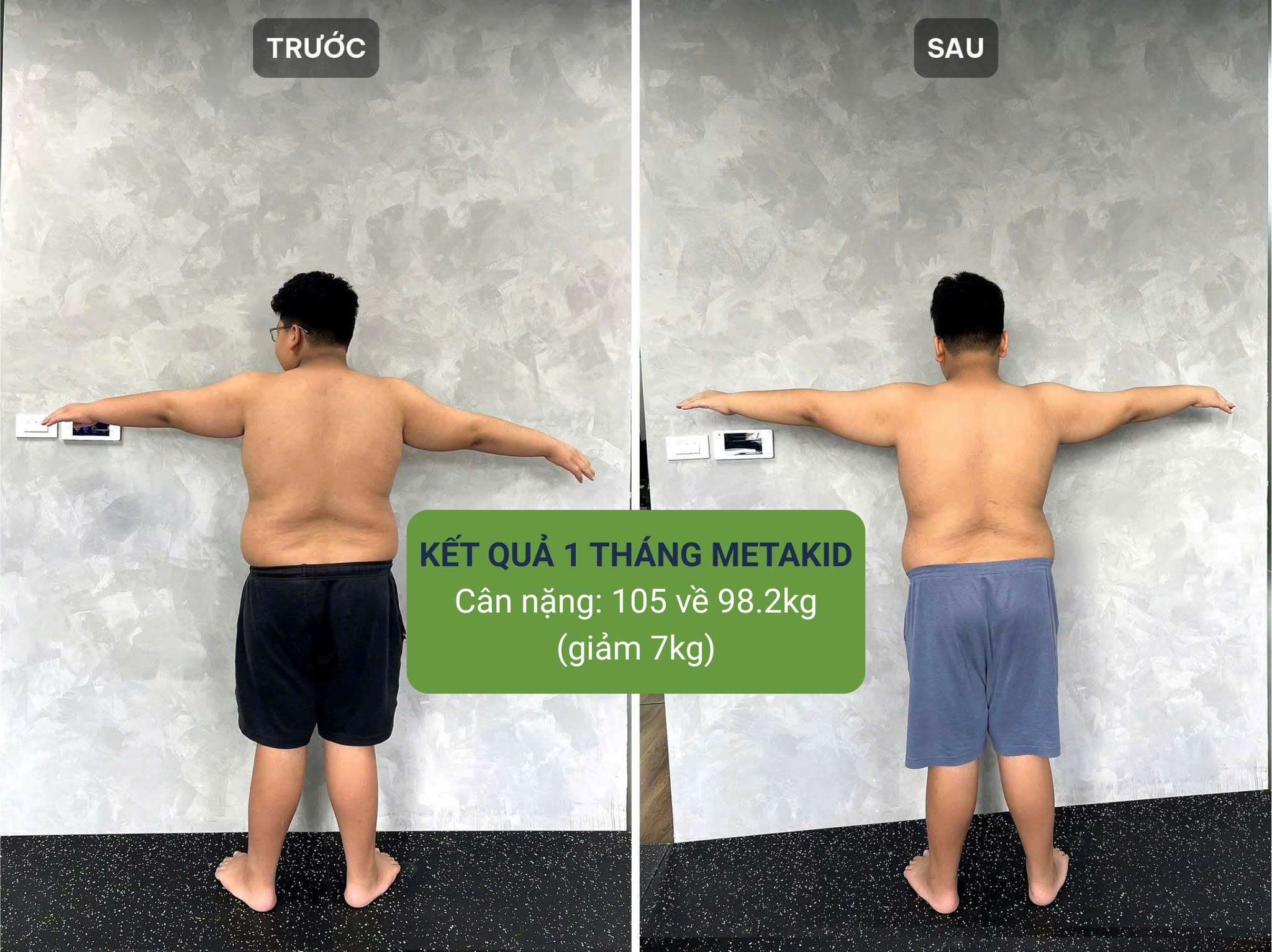 Kết quả giảm béo của trẻ tuổi teen tại Kangnam