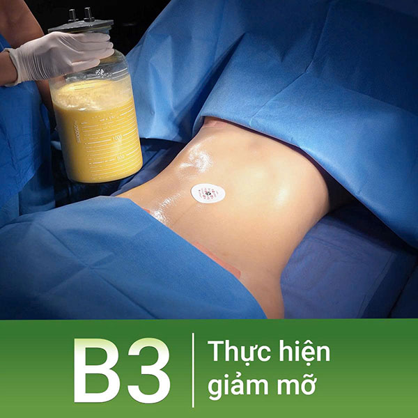 Thực hiện giảm mỡ