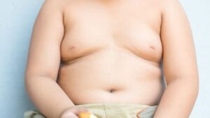 Béo phì ở trẻ có tự hết khi lớn không? Sự thật về nguy cơ kéo dài đến tuổi trưởng thành